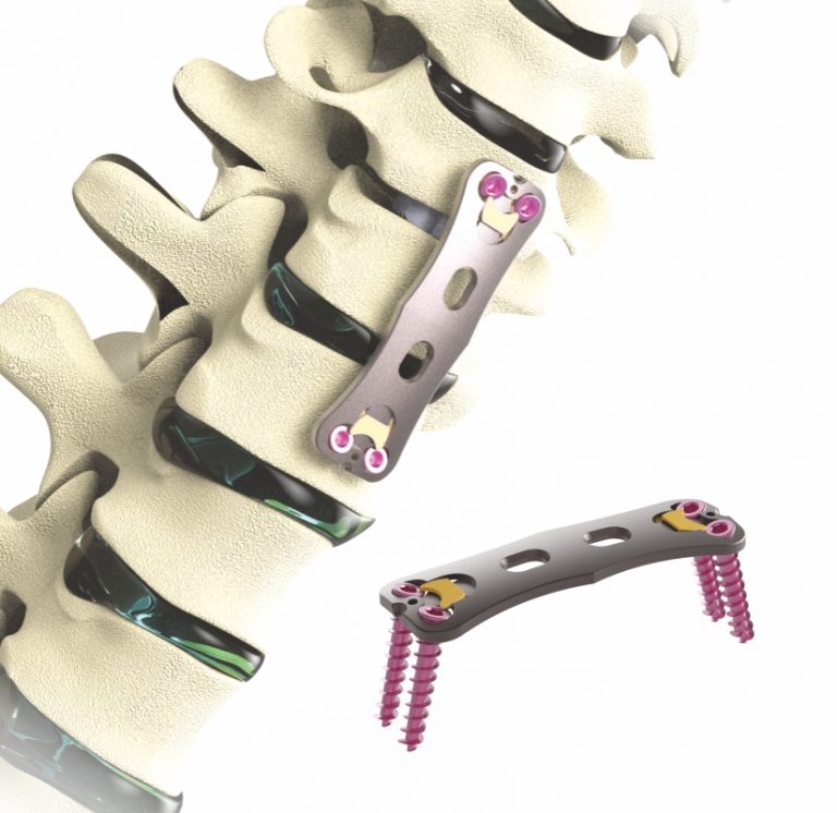 Anterior Cervical Plate System Orthopedic Spine Plates Kaulmed
